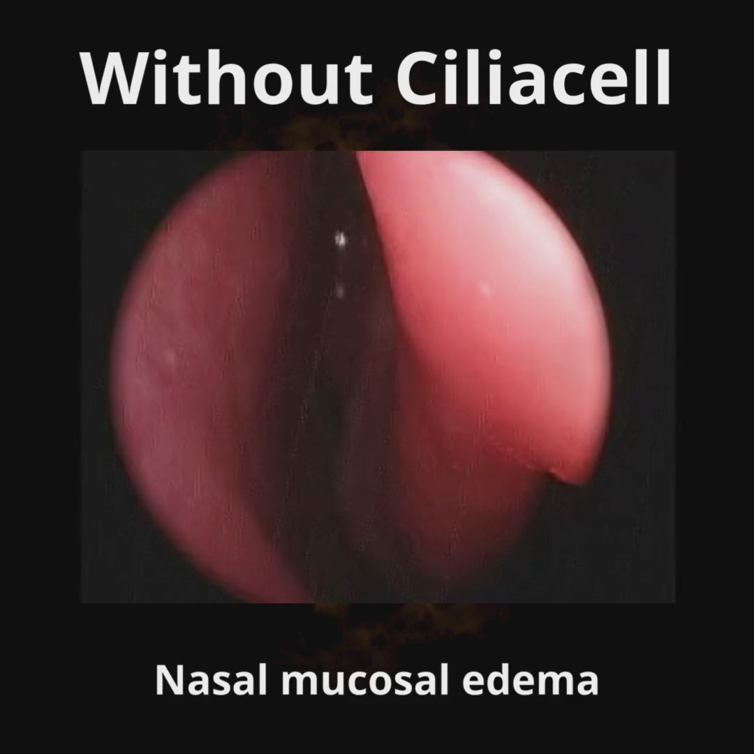 Load video: CiliaCell Nasal Spray - Adult