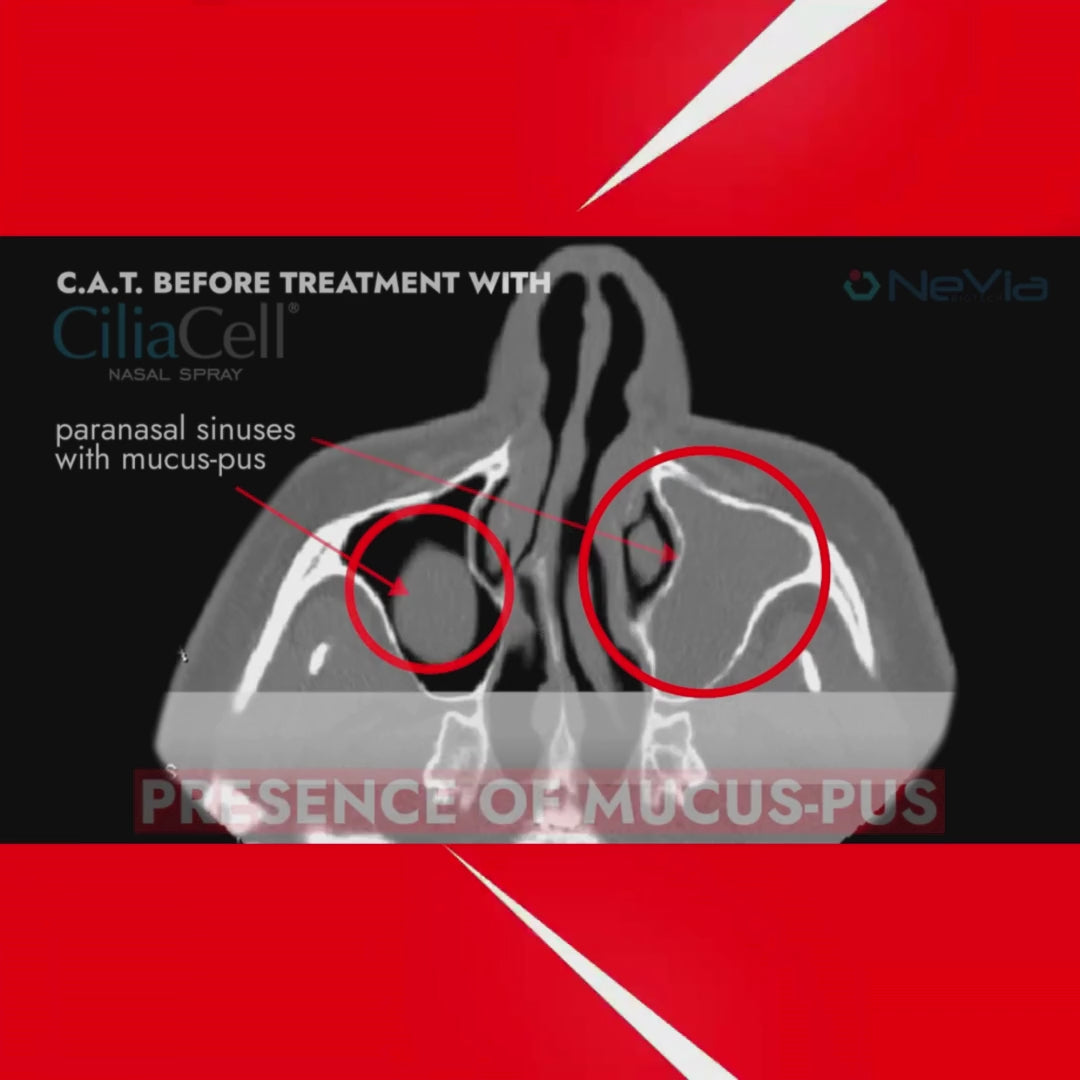 Load video: CiliaCell Nasal Spray - Adult